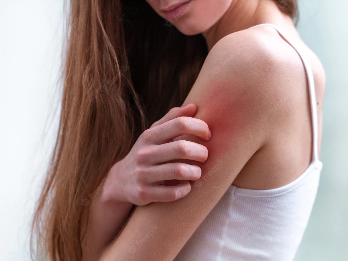 a young woman scratching her arms from a bite or irritation